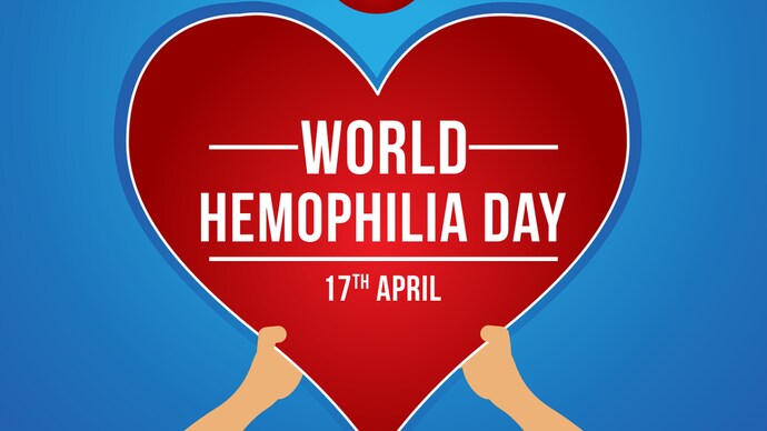 World Hemophilia Day 2022: History, significance, theme, wishes and quotes - India Today
