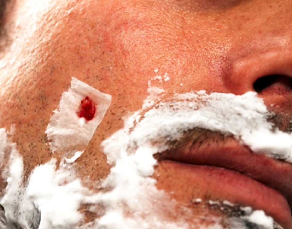 जल्दी नहीं भरते जख्म