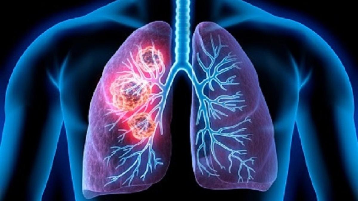 9 घंटे तक  स्किन पर जिंदा रहता है कोरोना