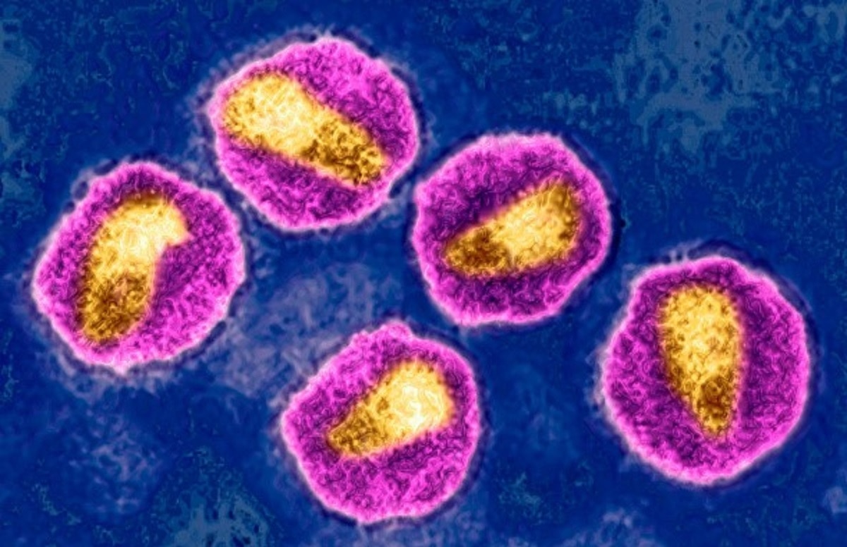 रूप बदलने वाला HIV