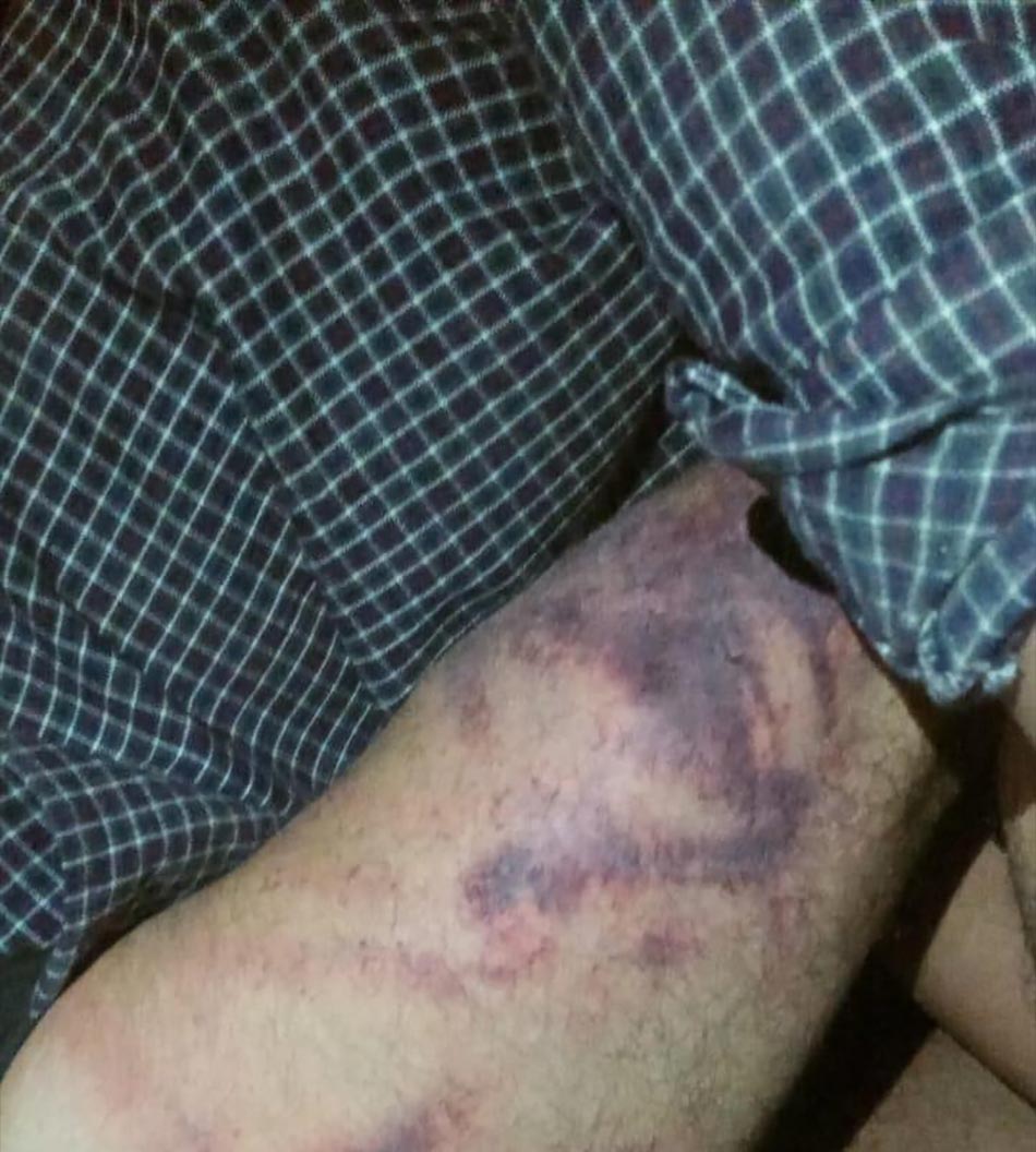 पुलिस ने पीड़ित को बुलाकर रिपोर्ट दर्ज करवाई है.