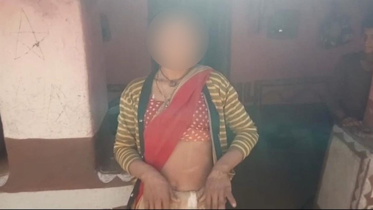 Husband torture Wife