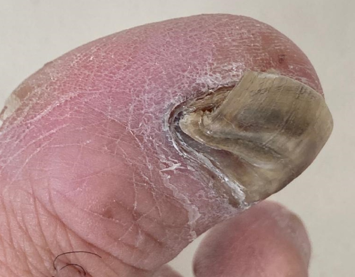 अस्पताल में मेहुल चोकसी