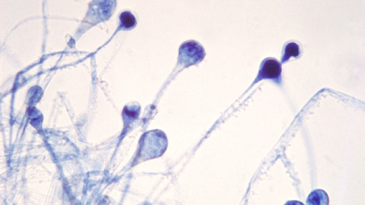 किस शर्त पर रिजेक्ट हो सकता है क्लेम?