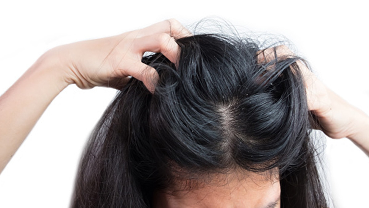 रूखे और बेजान बाल