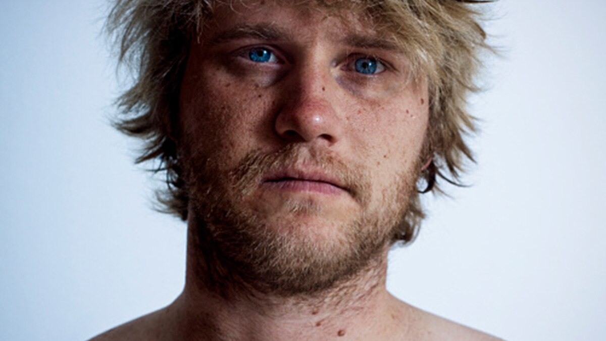 तिल या मस्से