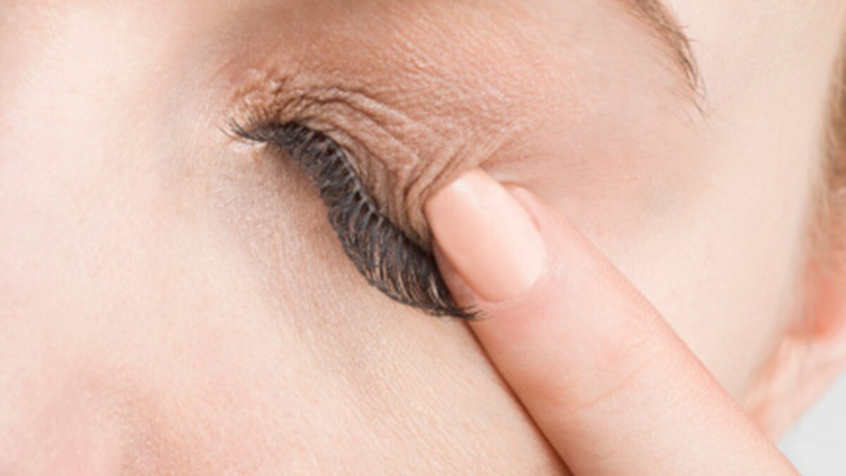 पलकों का लटकना