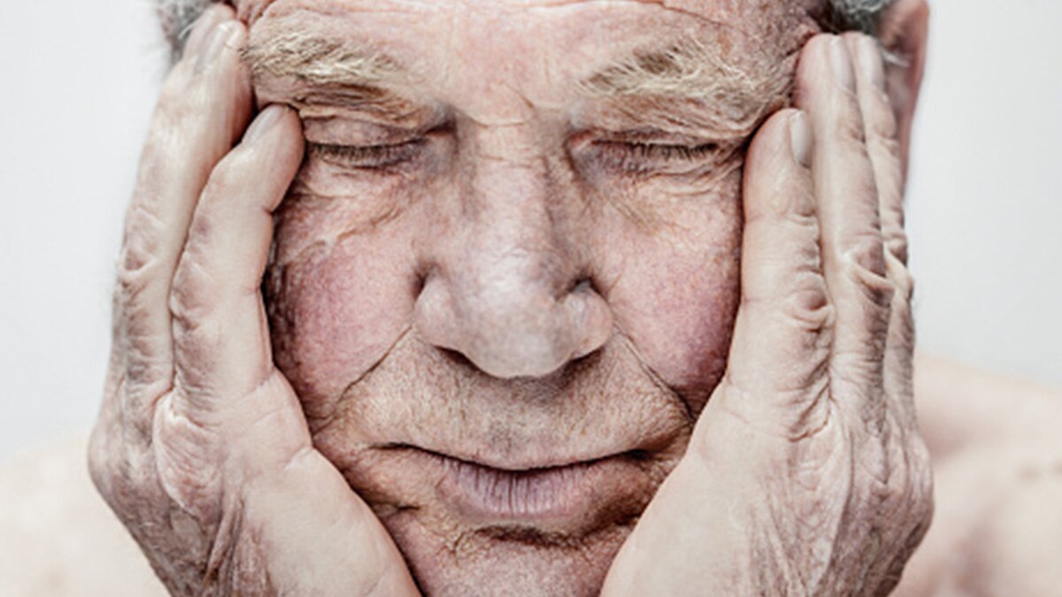 चेहरे के बालों का झड़ना