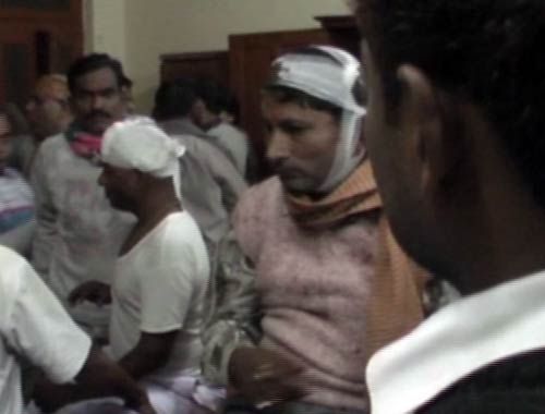 बनारस में हुए ब्‍लास्‍ट की तस्‍वीरें | घाटों का शहर