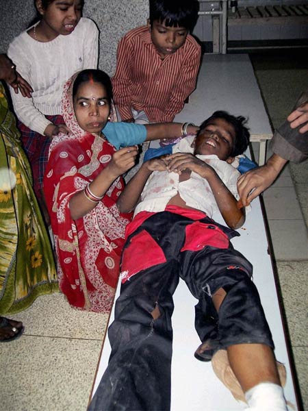 बनारस में हुए ब्‍लास्‍ट की तस्‍वीरें | घाटों का शहर