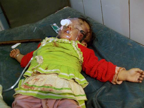 बनारस में हुए ब्‍लास्‍ट की तस्‍वीरें | घाटों का शहर