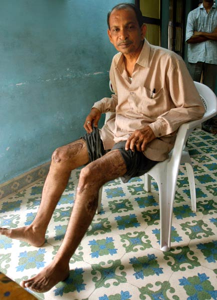 दर्द गोधरा कांड का