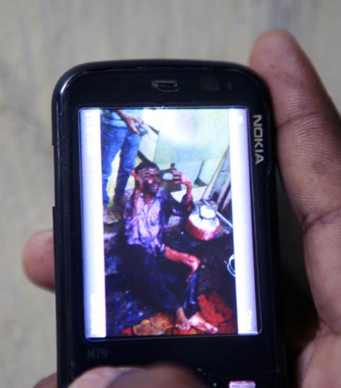 देखें विस्‍फोट के बाद मुंबई का क्या है हाल |  मुंबई ब्‍लास्‍ट