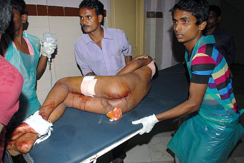 देखें विस्‍फोट के बाद मुंबई का क्या है हाल |  मुंबई ब्‍लास्‍ट