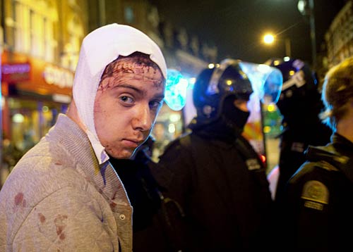 दंगे की आग में जल रहा है लंदन | मुश्किल में ब्रिटेन