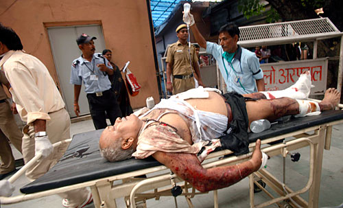 देखें दिल्‍ली में कैसे हुआ बम ब्‍लास्‍ट | क्‍या है सुरक्षा का हाल