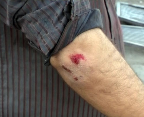 देखें जोधपुर में आजतक पर कैसे हुआ हमला