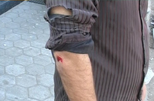 देखें जोधपुर में आजतक पर कैसे हुआ हमला