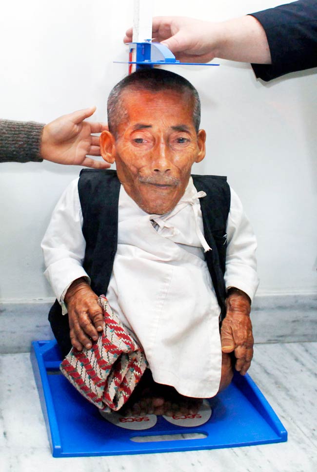 दुनिया के सबसे बौने आदमी की तस्‍वीरें
