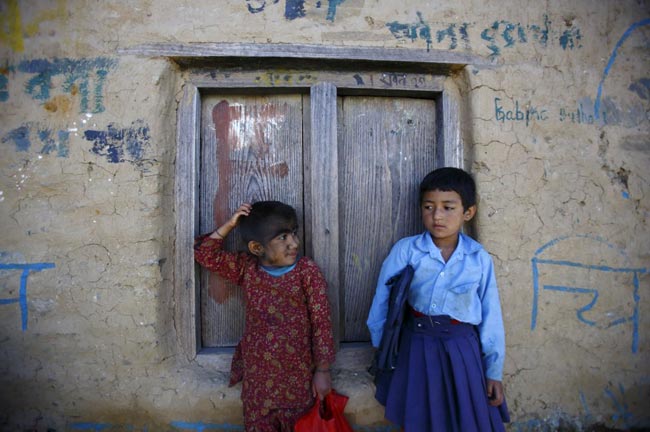 इस परिवार के चेहरे पर हैं सिर से ज्‍यादा बाल