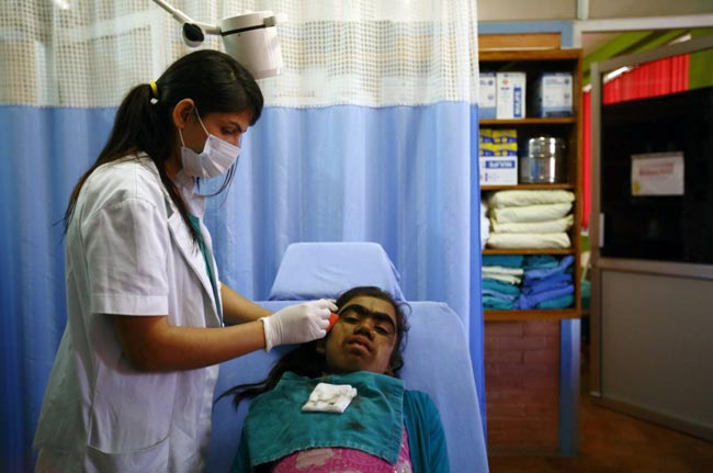 इस परिवार के चेहरे पर हैं सिर से ज्‍यादा बाल