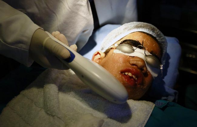 इस परिवार के चेहरे पर हैं सिर से ज्‍यादा बाल