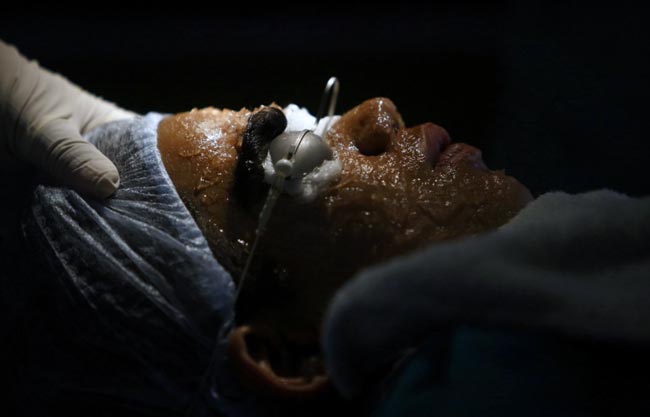 इस परिवार के चेहरे पर हैं सिर से ज्‍यादा बाल