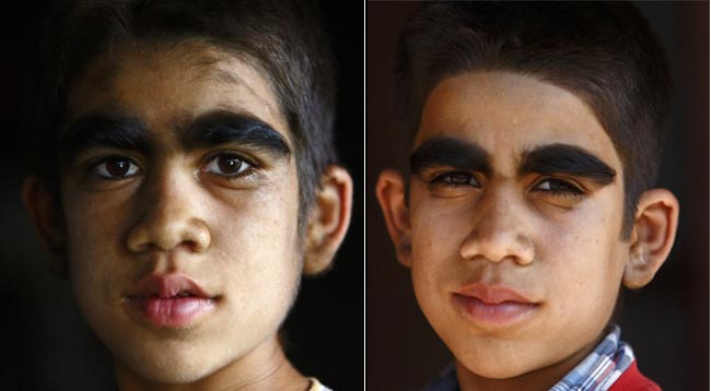 इस परिवार के चेहरे पर हैं सिर से ज्‍यादा बाल