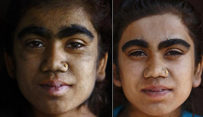 इस परिवार के चेहरे पर हैं सिर से ज्‍यादा बाल