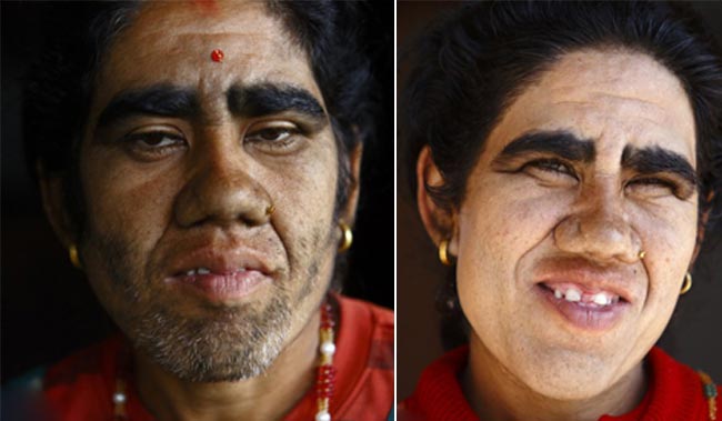 इस परिवार के चेहरे पर हैं सिर से ज्‍यादा बाल