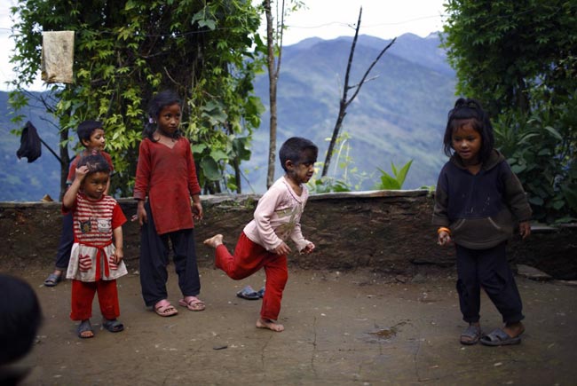 इस परिवार के चेहरे पर हैं सिर से ज्‍यादा बाल