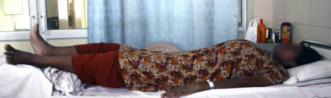 अब नहीं बढ़ेगी दुनिया की सबसे लंबी महिला की लंबाई