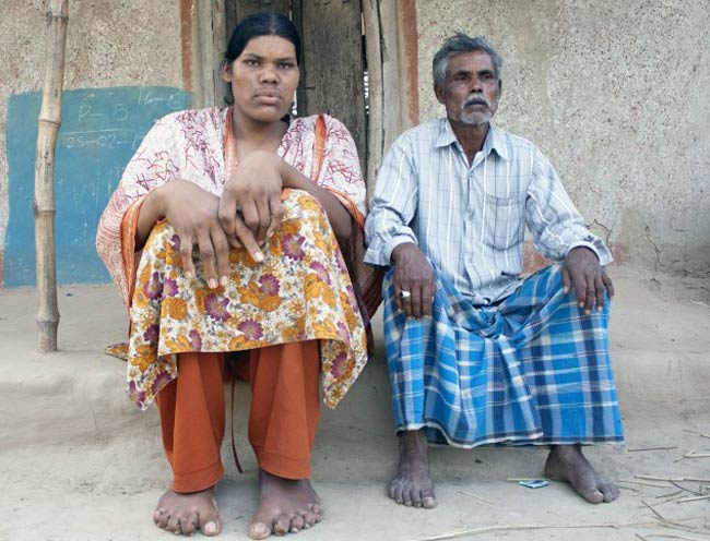 अब नहीं बढ़ेगी दुनिया की सबसे लंबी महिला की लंबाई