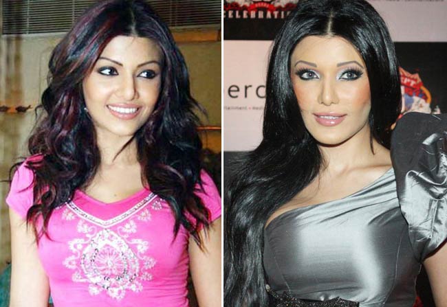 कराई खूबसूरती के लिए सर्जरी लेकिन हो गया कबाड़ा