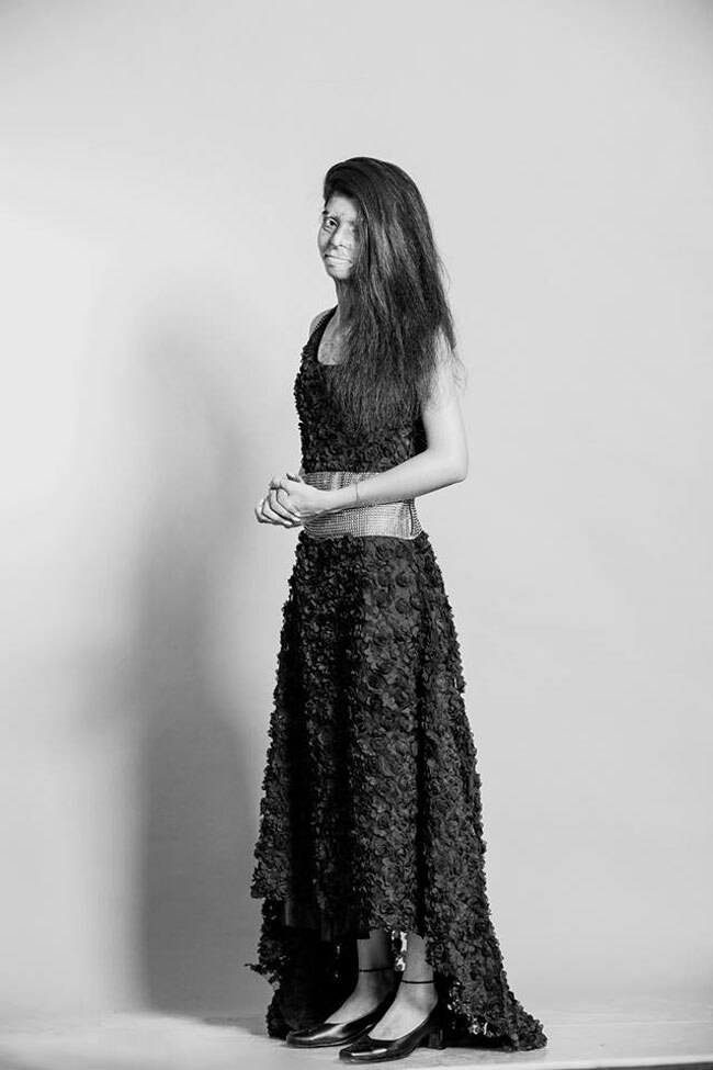 एसिड अटैक फाइटर्स का खूबसूरत फोटोशूट