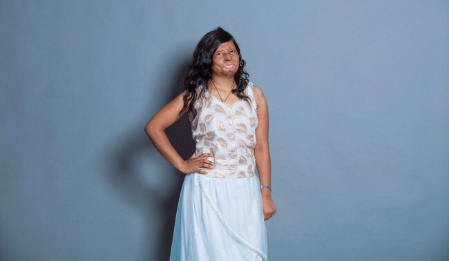 एसिड अटैक फाइटर्स का खूबसूरत फोटोशूट