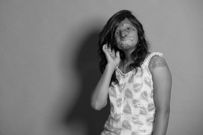 एसिड अटैक फाइटर्स का खूबसूरत फोटोशूट