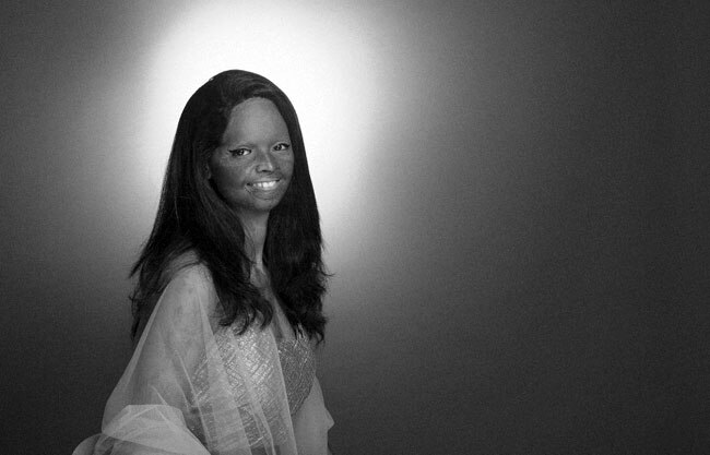 एसिड अटैक फाइटर्स का खूबसूरत फोटोशूट