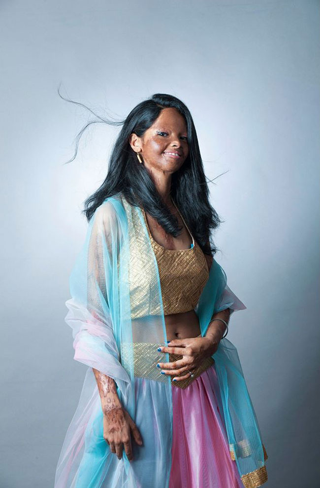 एसिड अटैक फाइटर्स का खूबसूरत फोटोशूट