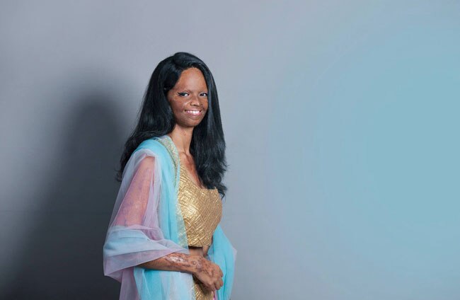 एसिड अटैक फाइटर्स का खूबसूरत फोटोशूट