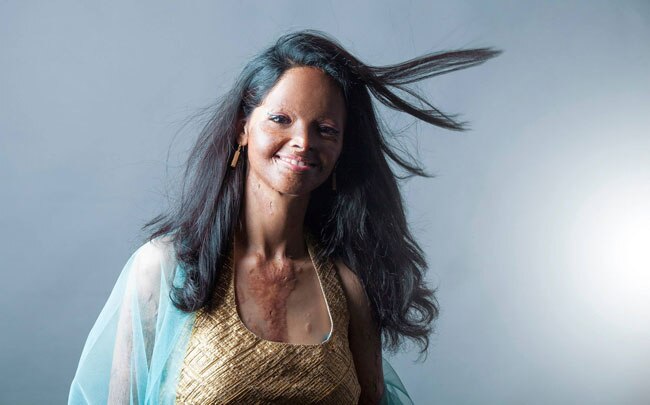 एसिड अटैक फाइटर्स का खूबसूरत फोटोशूट