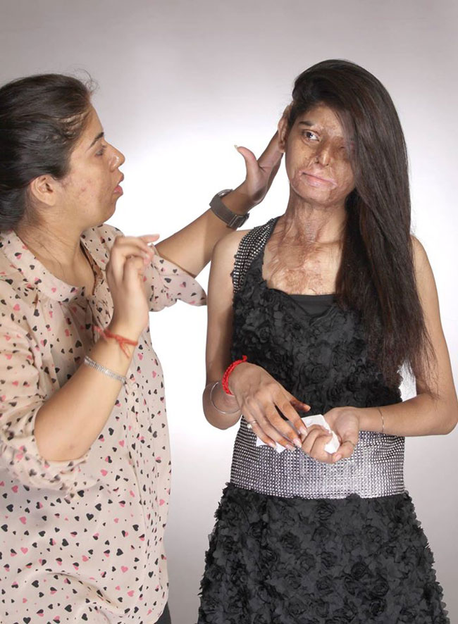 एसिड अटैक फाइटर्स का खूबसूरत फोटोशूट