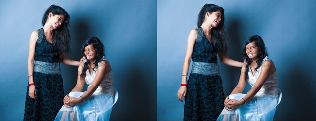 एसिड अटैक फाइटर्स का खूबसूरत फोटोशूट