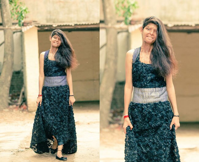 एसिड अटैक फाइटर्स का खूबसूरत फोटोशूट