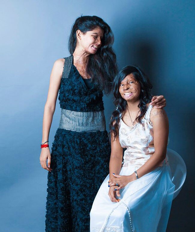 एसिड अटैक फाइटर्स का खूबसूरत फोटोशूट