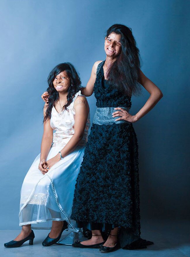 एसिड अटैक फाइटर्स का खूबसूरत फोटोशूट