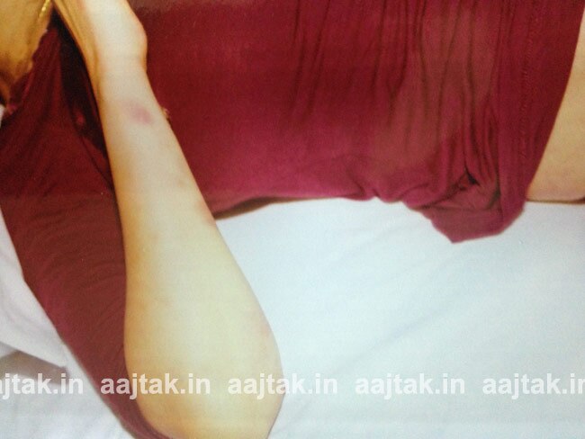 सुनंदा पुष्कर की Dead Body की Exclusive तस्वीरें..