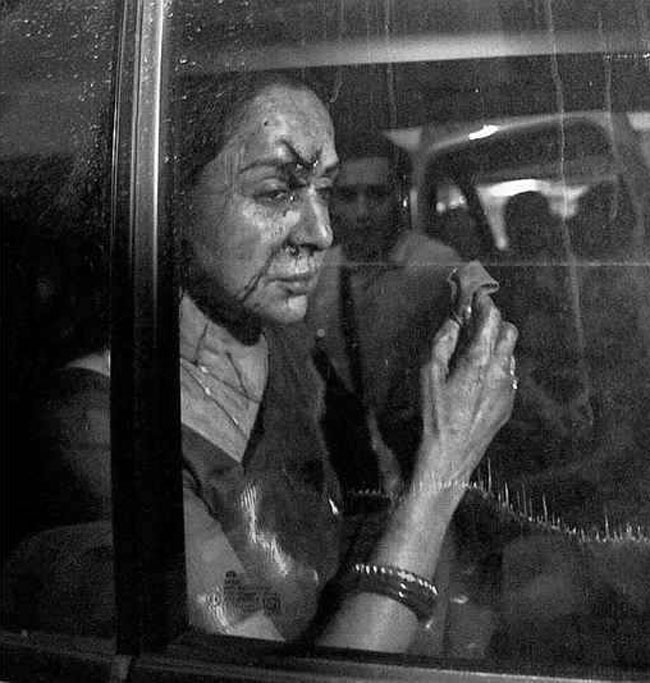 तस्वीरें: सड़क हादसे में लहूलुहान हुईं हेमा मालिनी...