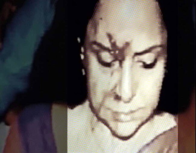 तस्वीरें: सड़क हादसे में लहूलुहान हुईं हेमा मालिनी...