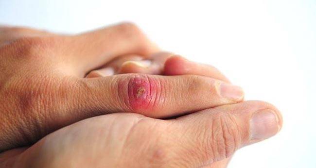 बैंगन में छिपे हैं सेहत के ये 5 राज